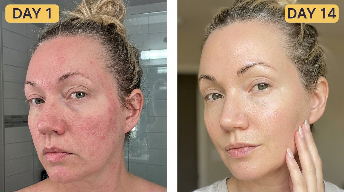 Skin Finally Looks Calm and Even