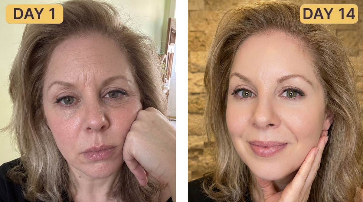 Visibly Plumped & Smoother Texture